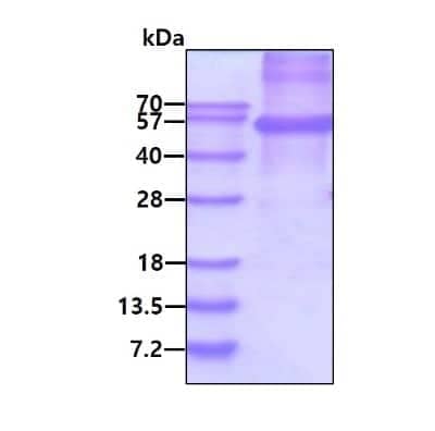 SDS-PAGE: Recombinant Human CD30/TNFRSF8 His Protein [NBP2-22660]